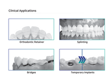 Load image into Gallery viewer, UP Fiber Splint