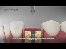 Load and play video in Gallery viewer, Screw Removal Kit for Narrow Platform