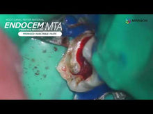 Load and play video in Gallery viewer, EndoCem Premix MTA