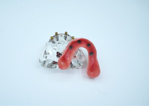 4 Implant Upper Overdenture Jaw Model