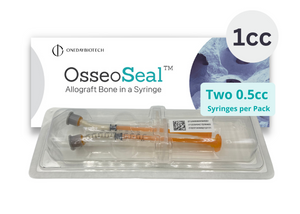 OsseoSeal Prefilled Bone in Syringe